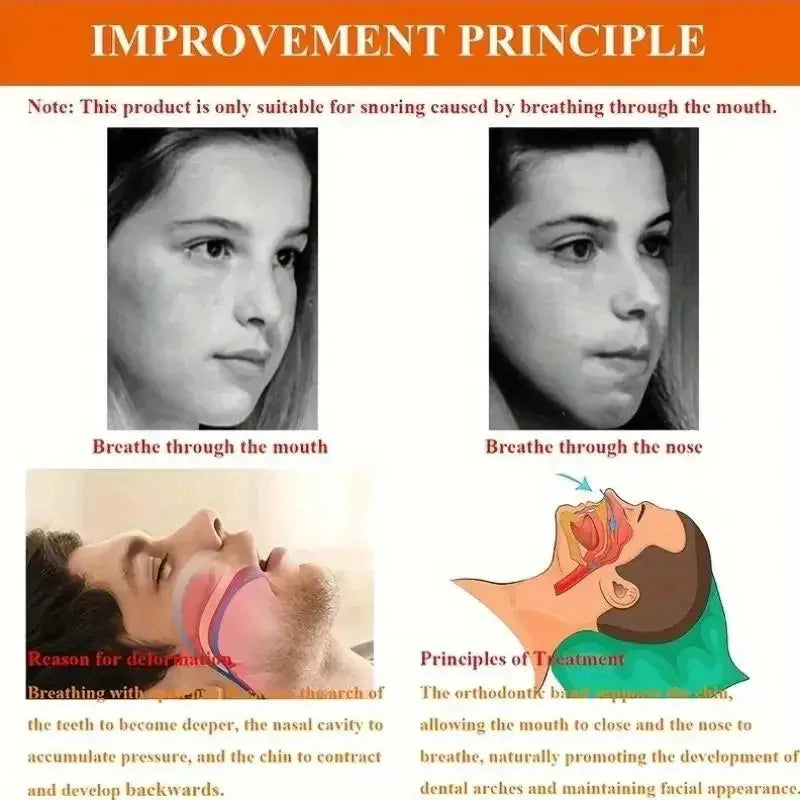 Anti-snoring Band Open Mouth Breathing Corrective Anti-snoring Chin