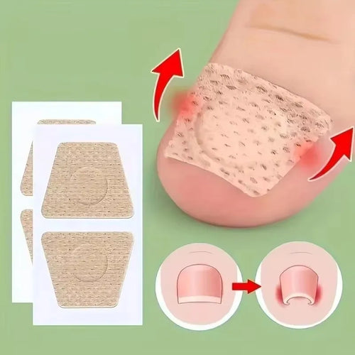 Nail Repair Patch Grey Fungal Nails Thickening Soft Paronychia