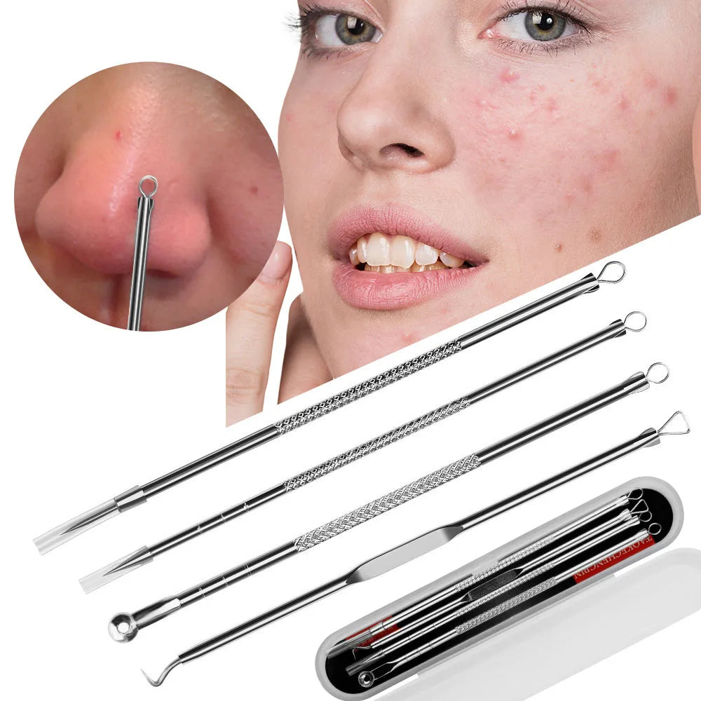 Acne Needle and Blackhead Removal Set