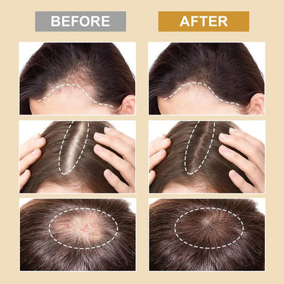 Unlock Rapid Hair Growth with PURC Biotin Hair Growth Products - Advanced Hair Loss Treatment for Men & Women, Fast-Acting Spray & Thicken Oil for Regrowth and Care