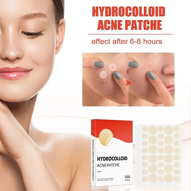 144pcs/set Face Skin Care Acne Pimple Patch 2 Sizes Invisible