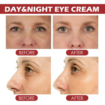 Retinol Eye Cream Collagen Multibalm Stick Reduce Wrinkles Eye Bag
