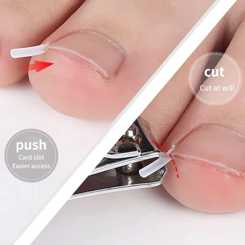 50Pcs/Box Ingrown Toenail Correction Strips Paronychia Correction