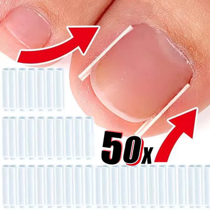 50Pcs/Box Ingrown Toenail Correction Strips Paronychia Correction