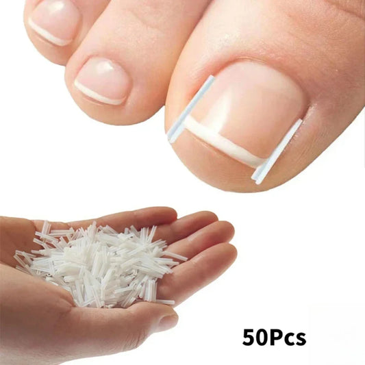 50Pcs Ingrown Toenail Correction Tool Ingrown Toe Nail Treatment