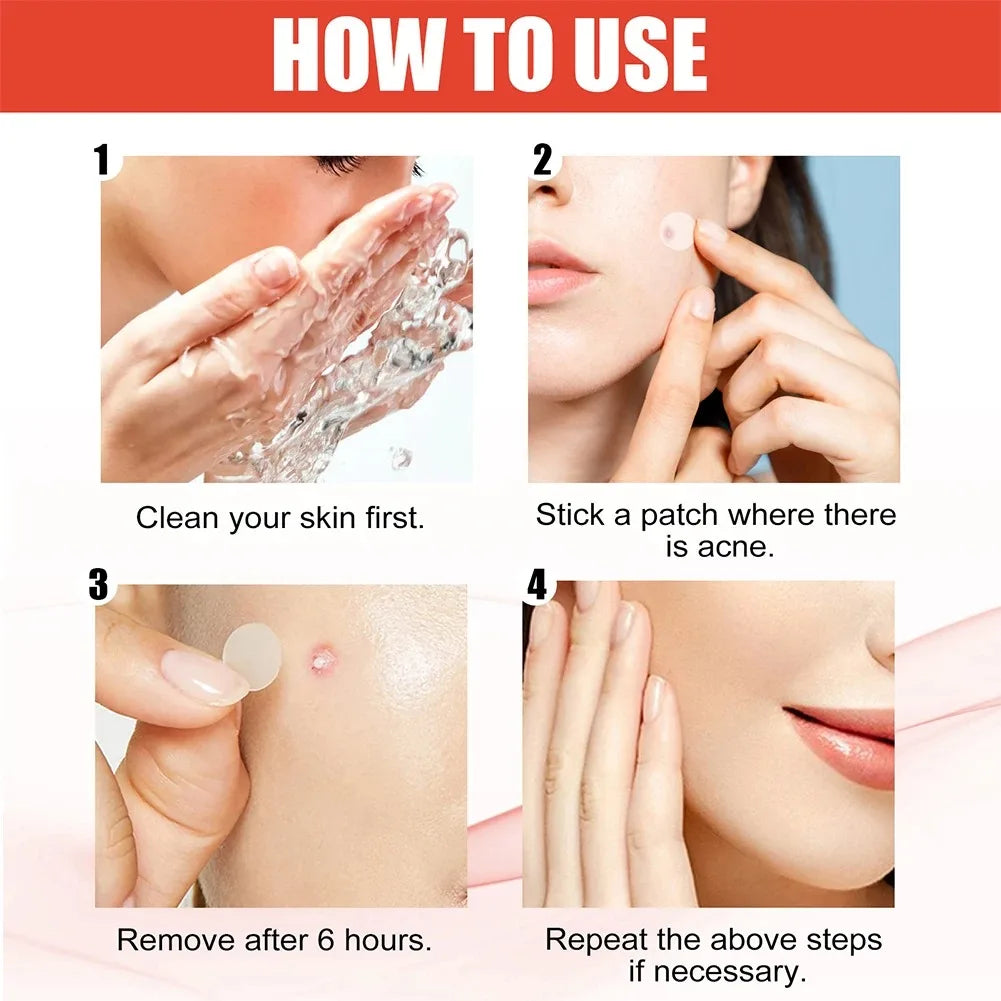 144pcs Face Acne Patch Invisible Skin Care Pimple Acne Patches