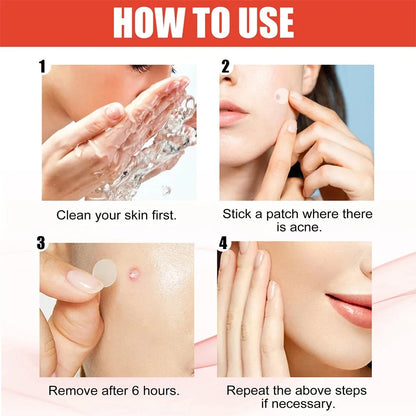 144pcs Face Acne Patch Invisible Skin Care Pimple Acne Patches