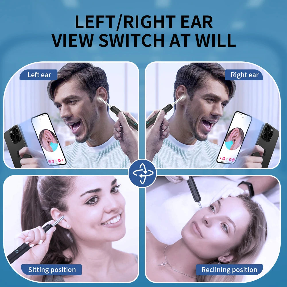Wireless Ear Wax Cleaner with Camera Safe Earwax Removal Endoscope