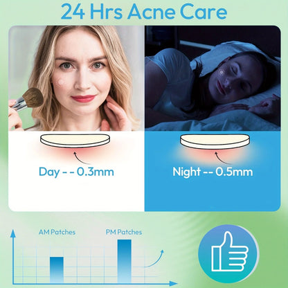 400/800pcs HITWORKER Hydrocolloid Acne Patches, 2 Sizes, Day & Night