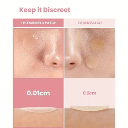 40 pieces of multi-color star acne patches, facial acne patches,