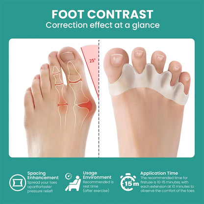 1 Pair Silicone Toe Separator, Bunion Corrector,Hammer Toe Corrector,