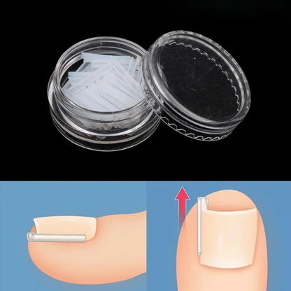 50Pcs Ingrown Toenail Correction Tool Ingrown Toe Nail Treatment