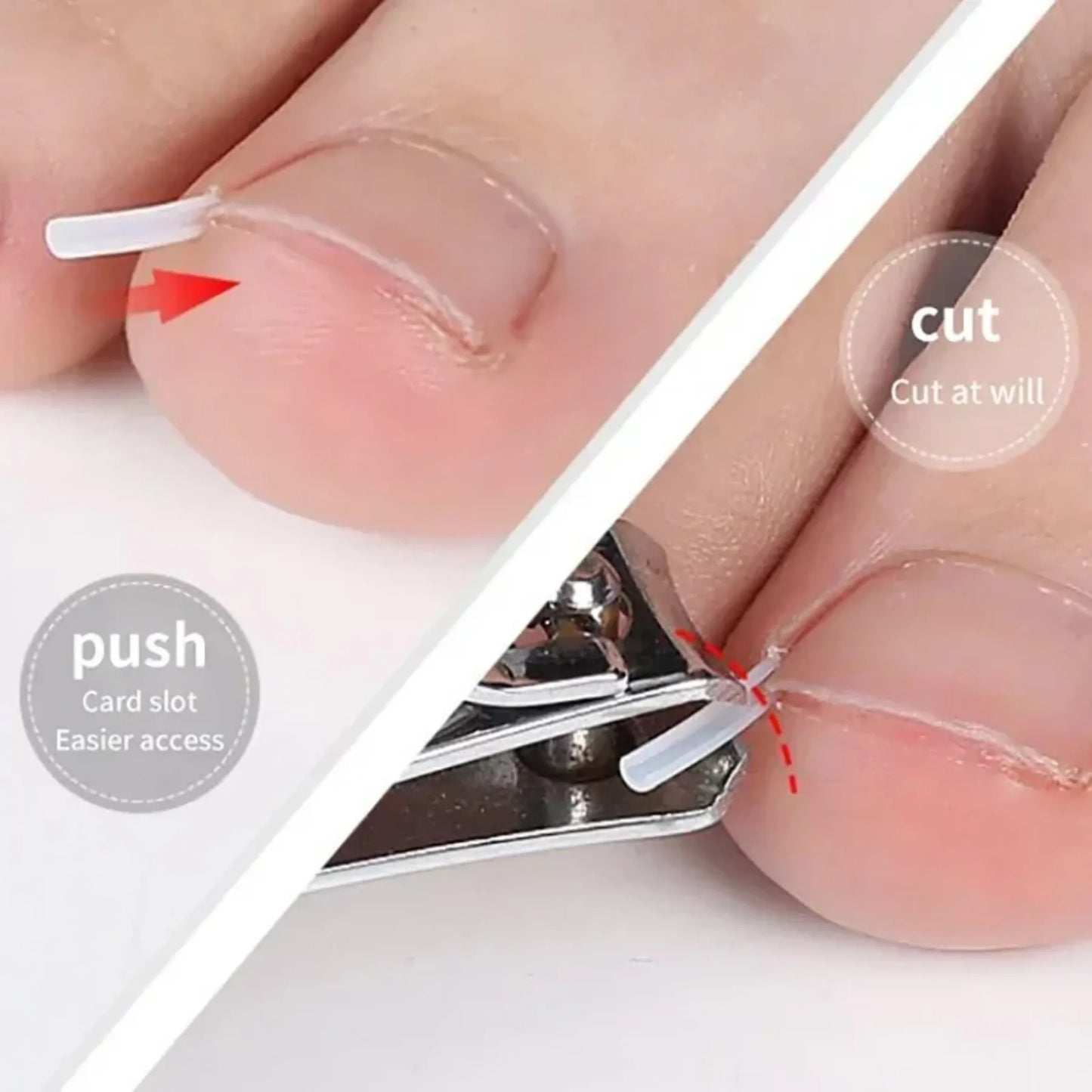 50Pcs Ingrown Toenail Correction Tool Ingrown Toe Nail Treatment