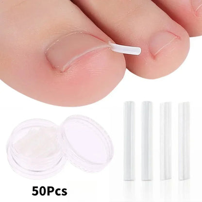 50Pcs Ingrown Toenail Correction Tool Ingrown Toe Nail Treatment
