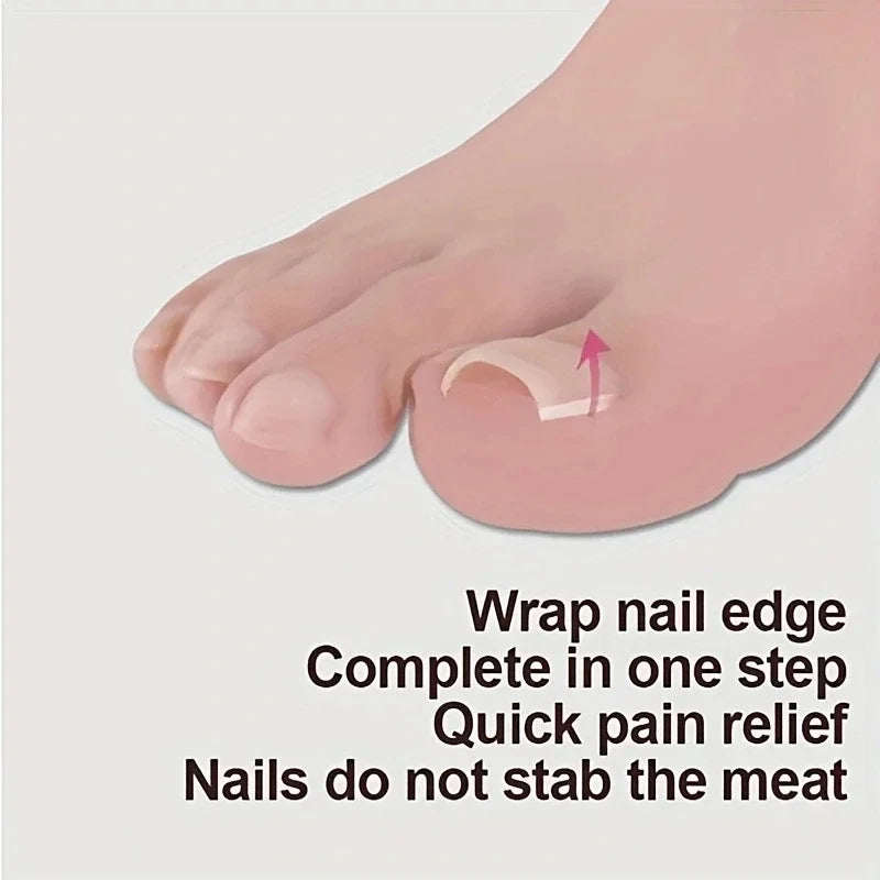 Ingrown Toenail Correction Tool Ingrown Toe Nail Treatment Elastic