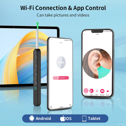 Wireless Ear Wax Cleaner with Camera Safe Earwax Removal Endoscope