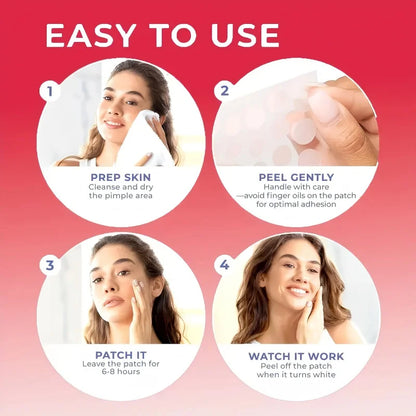 1200 pieces/set of hydrogel patches for acne coverage, suitable for