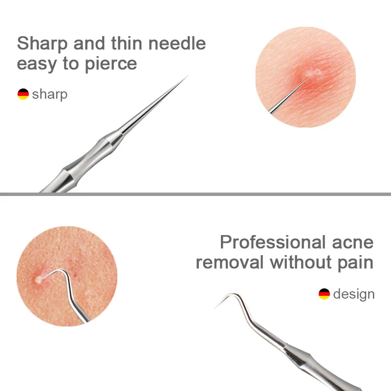 New German Acne Blackhead Removal Needles Pimples Blackhead Clip