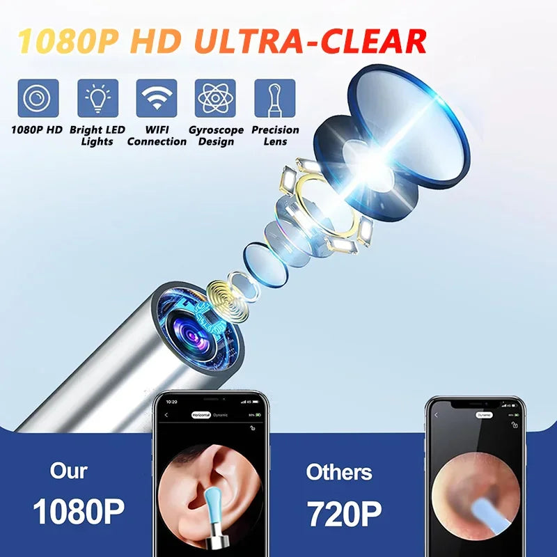 Visual Ear Wax Cleaner with Camera Safe Earwax Removal Endoscope with