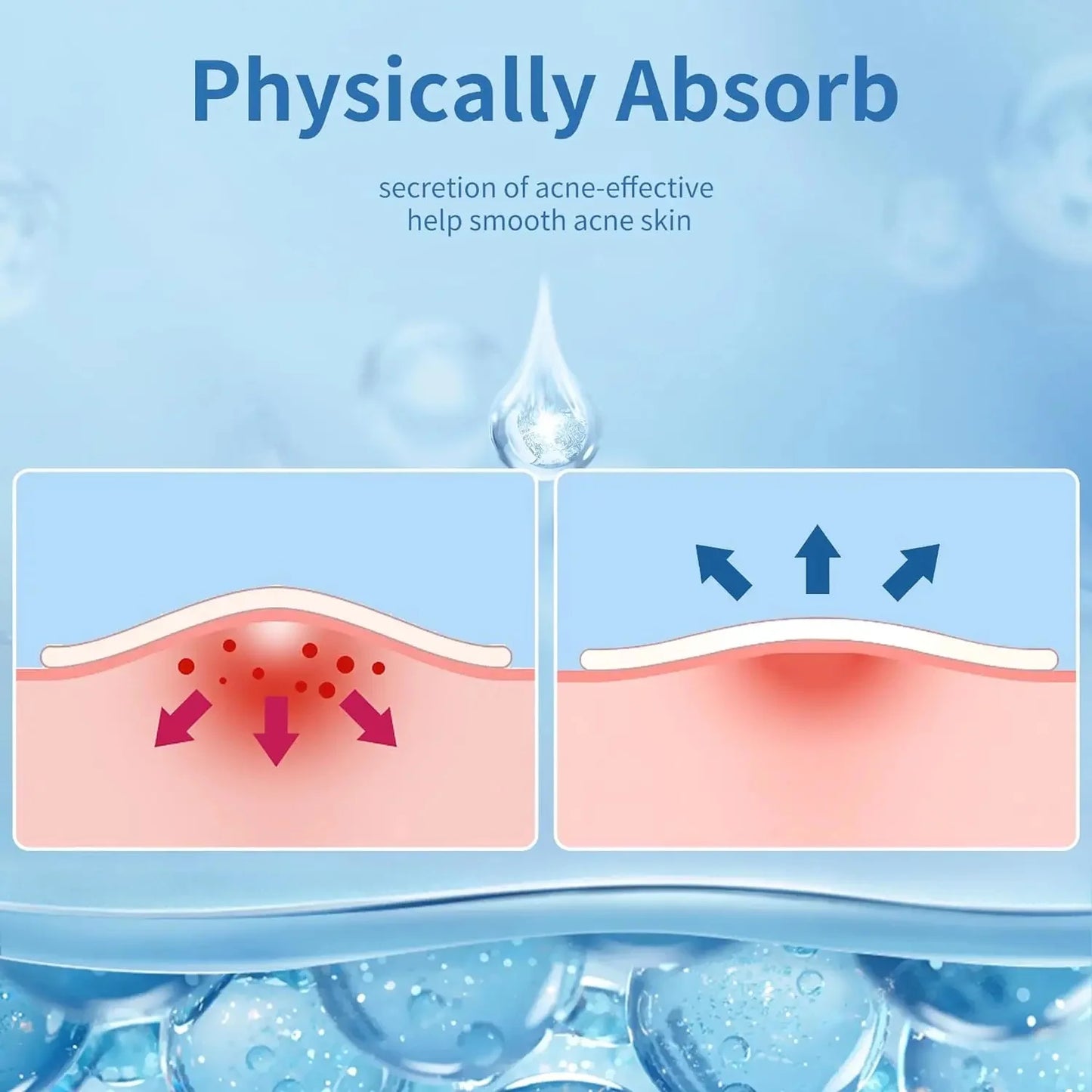 180/360PCS Invisible Acne Veneer Lump Sticker Reduce Acne Cleansing