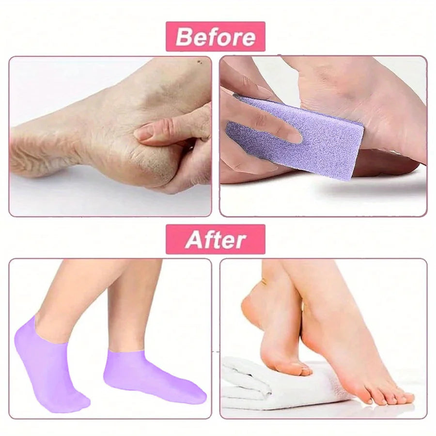 Moisturizing Foot Socks,Silicone Socks for Dry Cracked Feet Women's