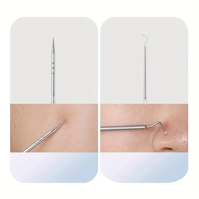 Stainless Steel 4/7/8pcs Acne Removal Tool Set - Blackhead & Pimple