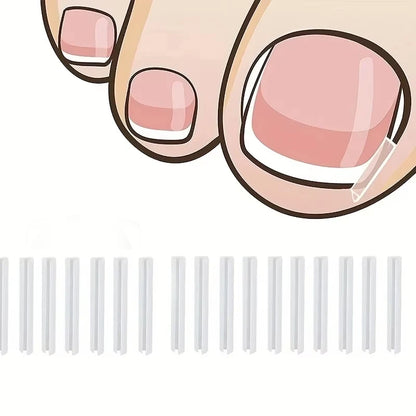 Ingrown Toenail Correction Tool Ingrown Toe Nail Treatment Elastic