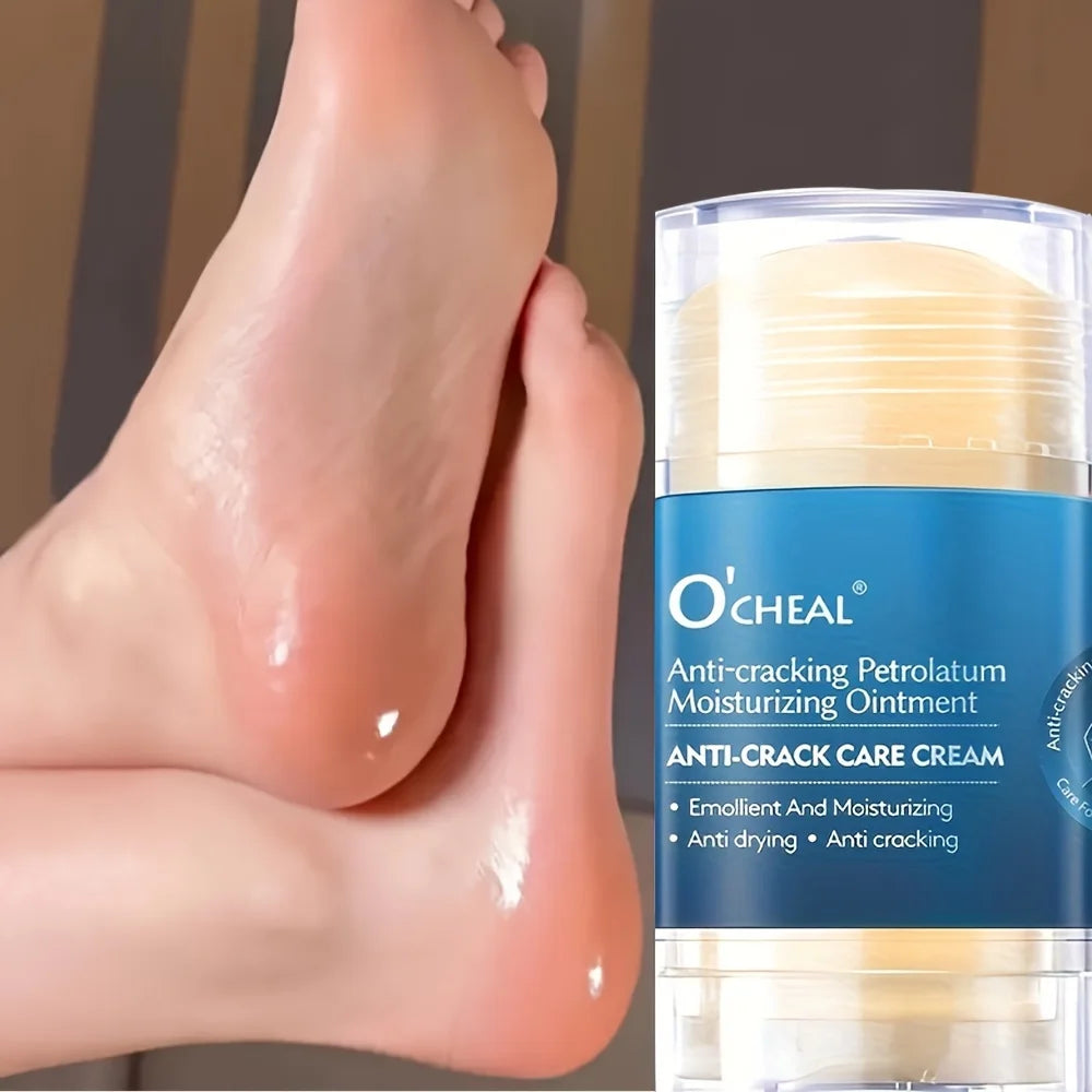 Anti Crack Foot Cream For Dry And Cracked Feet And Heels, Moisturizing