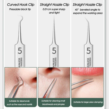 Acne Blackhead Removal Needles Stainless Steel Black Spot Blemish