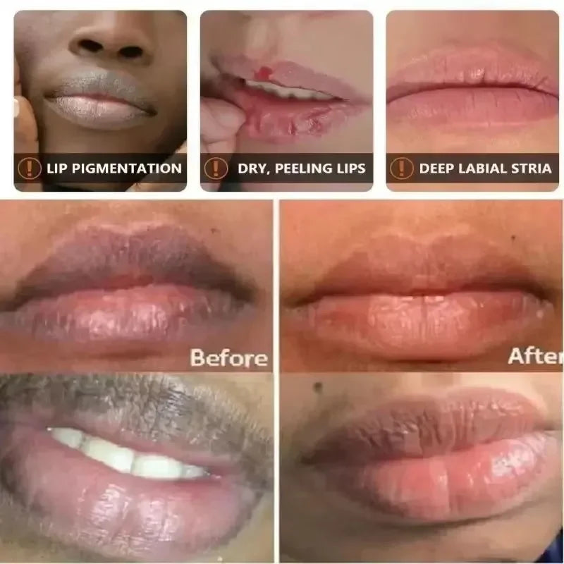 Remove Dark Lip Balm Lightening Melanin Mask Gloss Exfoliating Lip