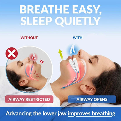 Anti-Snoring Mouthpiece Anti-Snoring Device Night Time Teeth