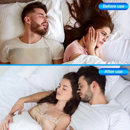 Anti Snoring Nose Strips for Breathing Correction Physical Expansion
