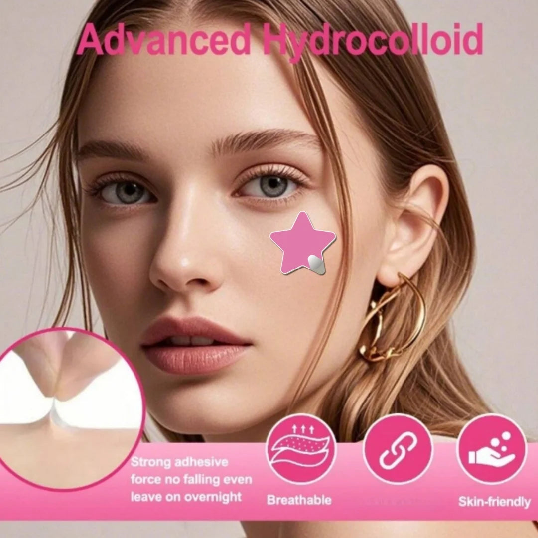 280pcs Star Acne Patch, Waterproof and Breathable, Daily Facial Use,