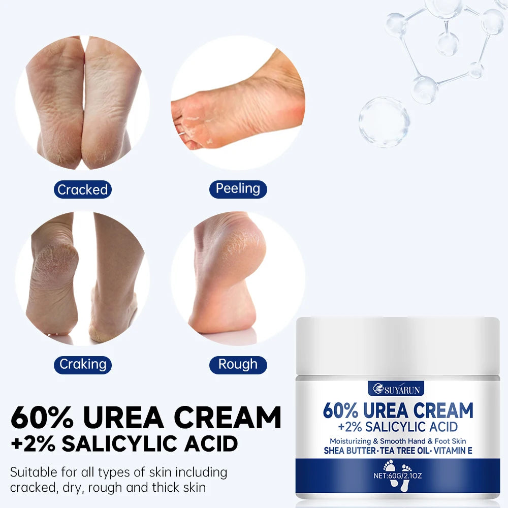 SUYARUN 60% Urea Foot Cream for Cracked Heels & Dry Skin - Intensive