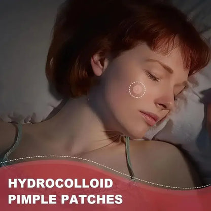 180/360/720 patches/box of hydrogel acne patches can effectively cover