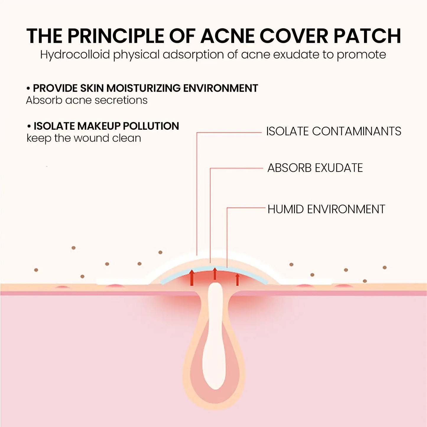 240 pieces of multi-color star acne patches, facial acne patches,