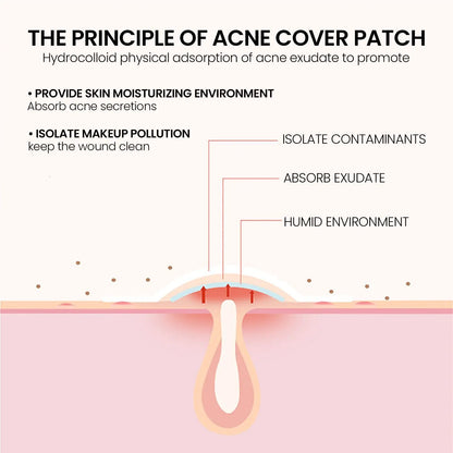 240 pieces of multi-color star acne patches, facial acne patches,