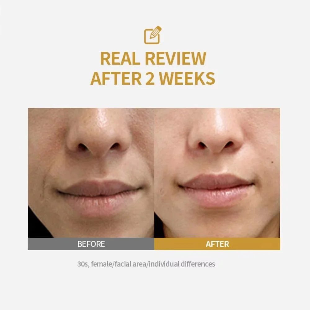 Peptide Intensive Lifting Ampoule,Deep Collagen Face Firming