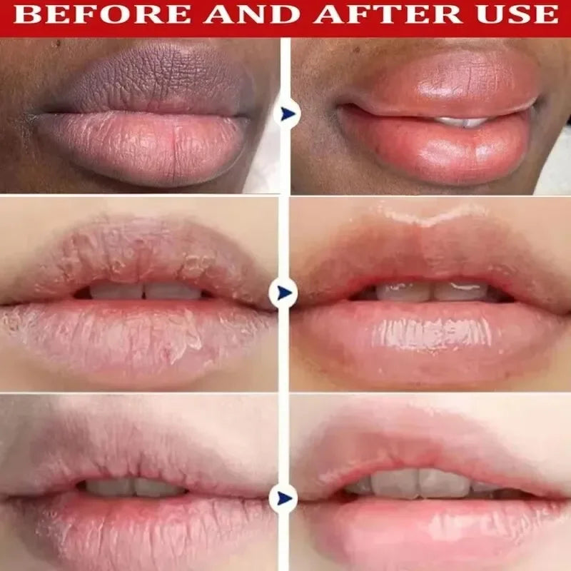 Remove Dark Lip Balm Lightening Melanin Mask Gloss Exfoliating Lip
