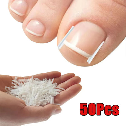 Ingrown Toenail Correction Tool Ingrown Toe Nail Treatment Elastic