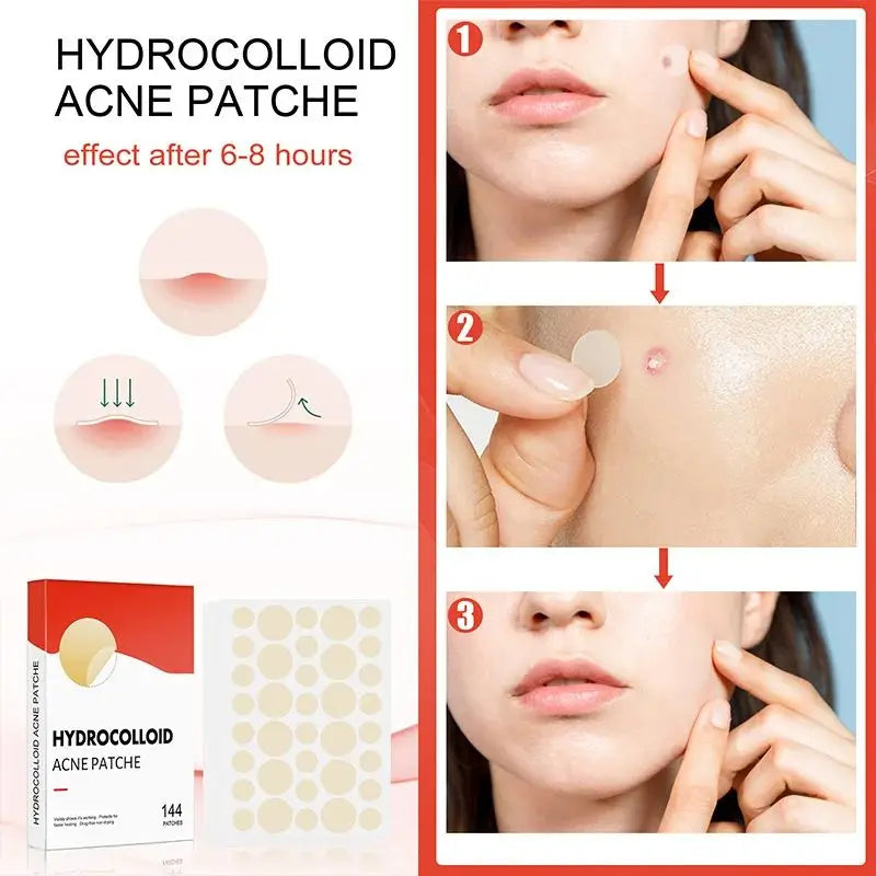 144pcs/set Face Skin Care Acne Pimple Patch 2 Sizes Invisible