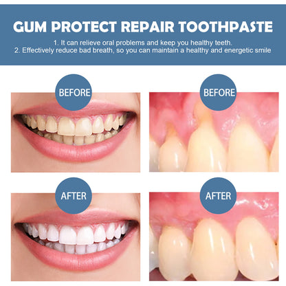 Dental Care Toothpaste Deep Cleaning Easily Removes Tooth Stains Teeth