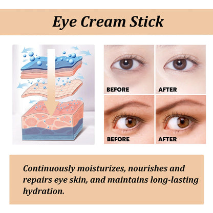 Snail Eye Cream Stick Lightening Dark Circles Collagen Fade Fine Lines