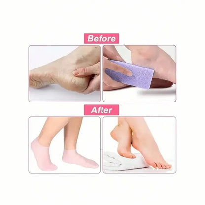 Moisturizing Foot Socks,Silicone Socks for Dry Cracked Feet Women's