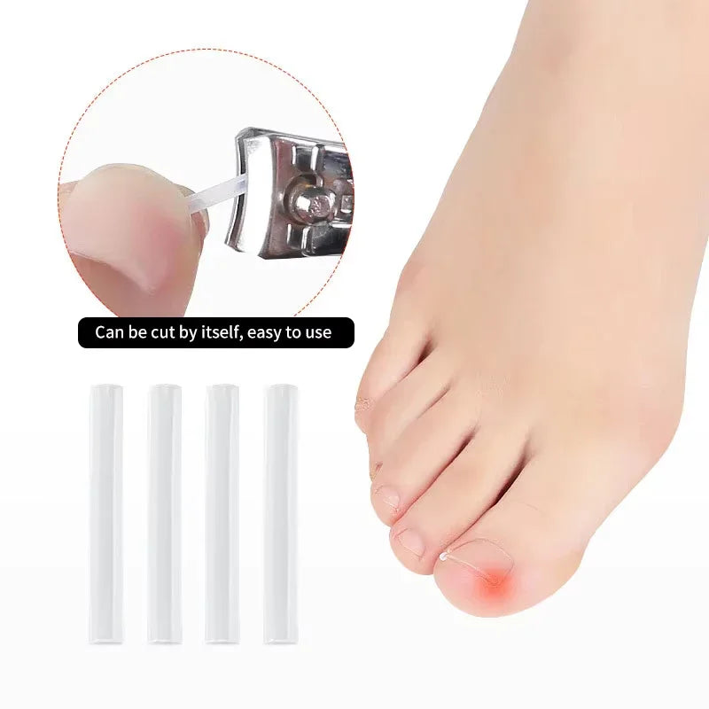 50Pcs Elastic Patch Sticker Pedicure Tool Ingrown Toenail Correction