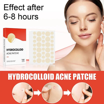 144pcs Face Acne Patch Invisible Skin Care Pimple Acne Patches