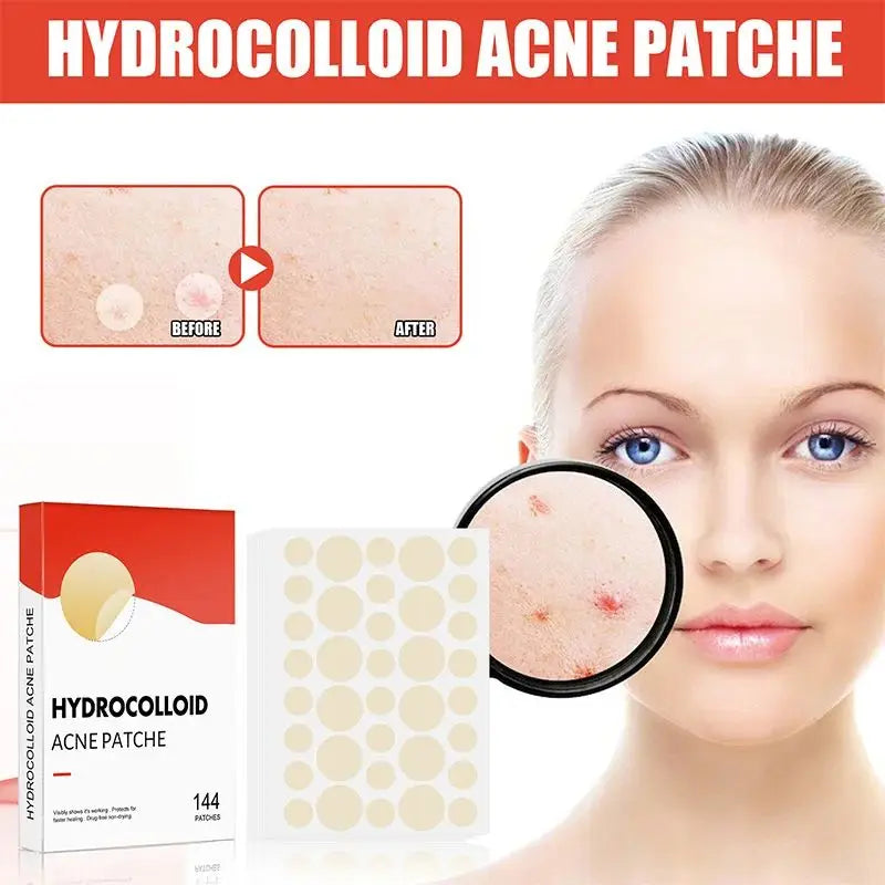 144pcs/set Face Skin Care Acne Pimple Patch 2 Sizes Invisible
