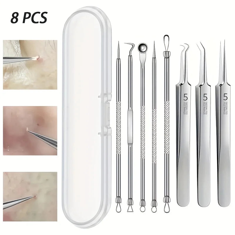 8-Piece Blackhead Remover Kit – Stainless Steel Blemish & Acne