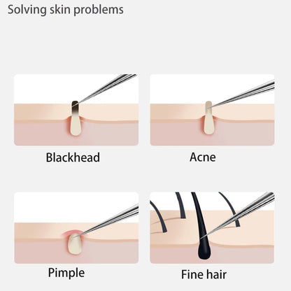 Acne Blackhead Removal Needles Stainless Steel Black Spot Blemish