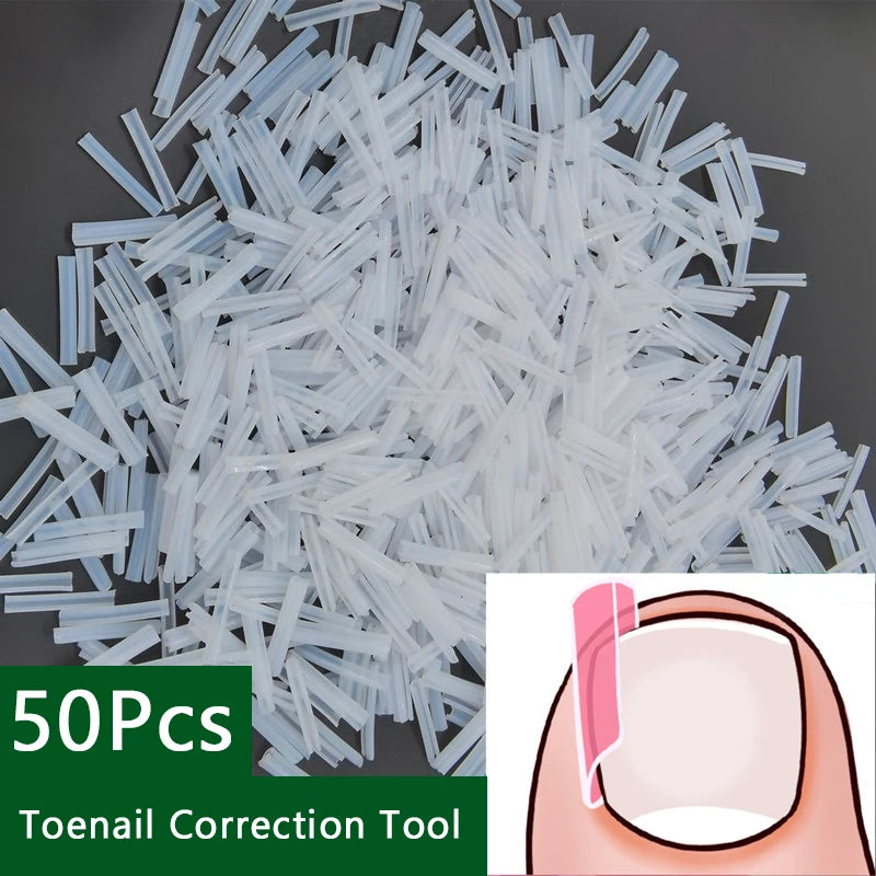 50Pcs/Box Ingrown Toenail Correction Strips Paronychia Correction